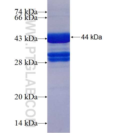 SPRY4 fusion protein Ag18574 SDS-PAGE