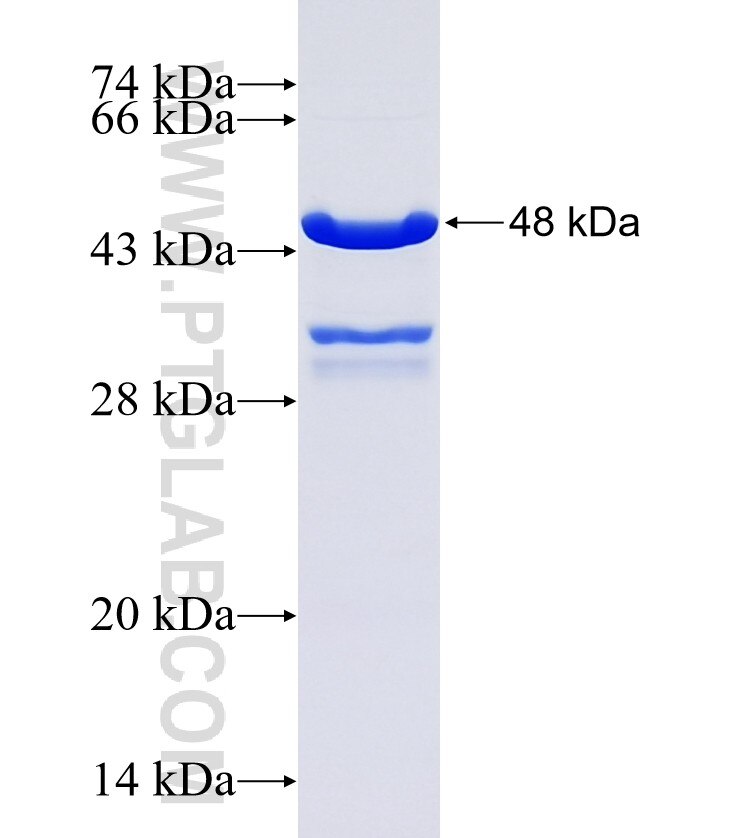 SPRY4 fusion protein Ag18574 SDS-PAGE