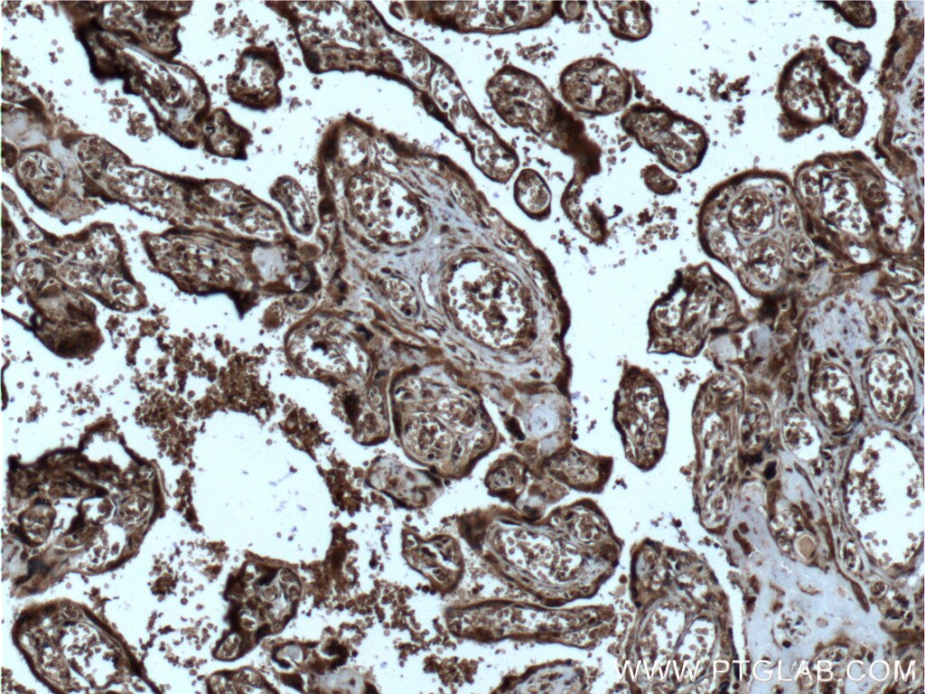 Immunohistochemistry (IHC) staining of human placenta tissue using SPRYD5 Polyclonal antibody (20802-1-AP)