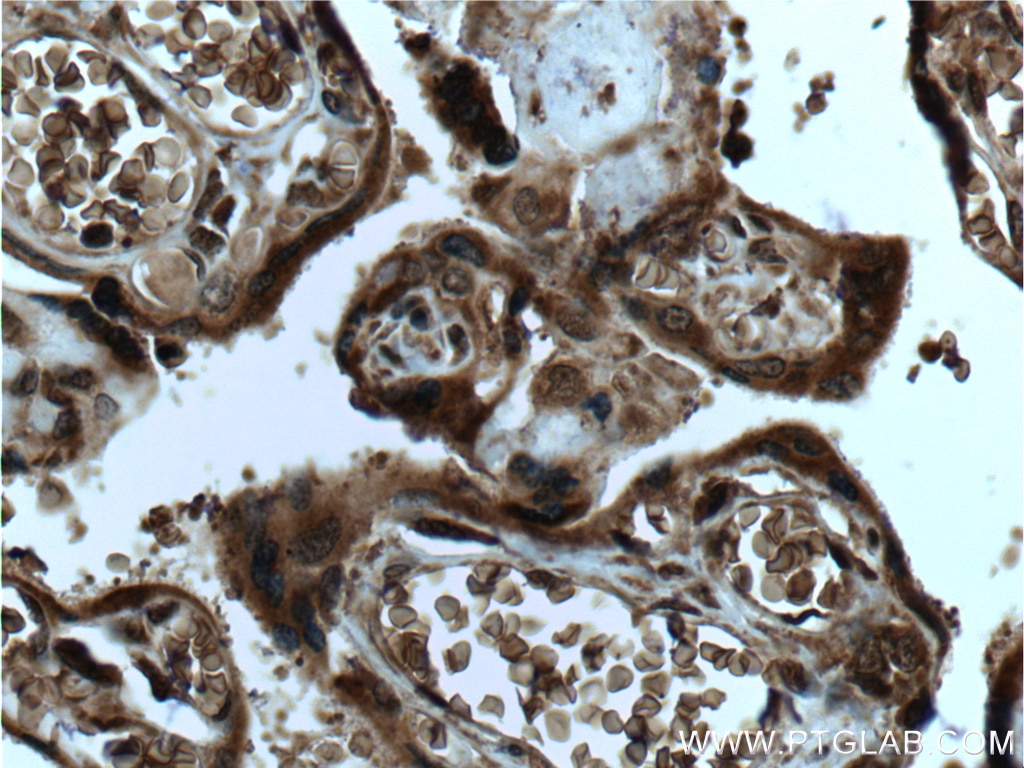 Immunohistochemistry (IHC) staining of human placenta tissue using SPRYD5 Polyclonal antibody (20802-1-AP)