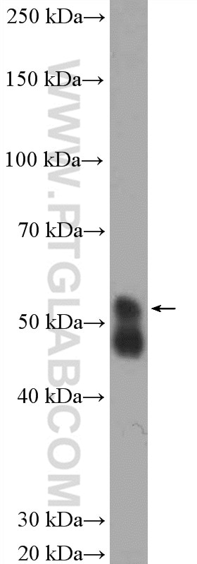 Western Blot (WB) analysis of rat brain tissue using SPRYD5 Polyclonal antibody (20802-1-AP)