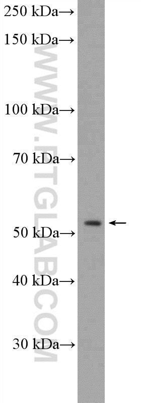 Western Blot (WB) analysis of Jurkat cells using SPRYD5 Polyclonal antibody (20802-1-AP)