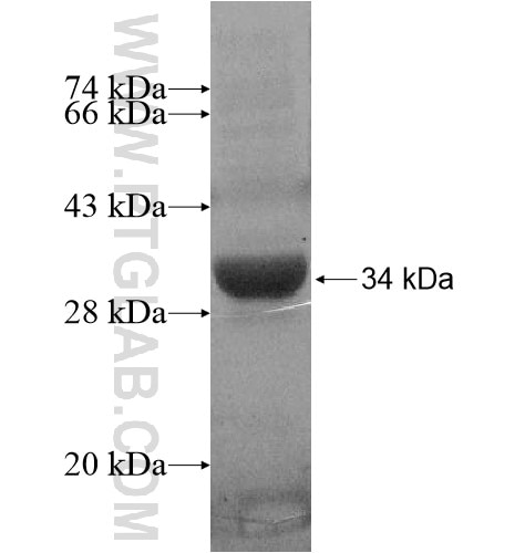 SPRYD5 fusion protein Ag14723 SDS-PAGE