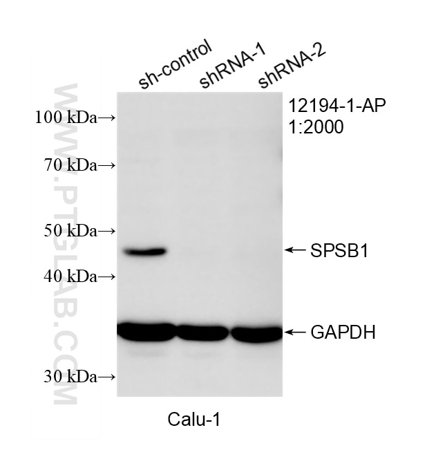 Western Blot (WB) analysis of Calu-1 cells using SPSB1 Polyclonal antibody (12194-1-AP)
