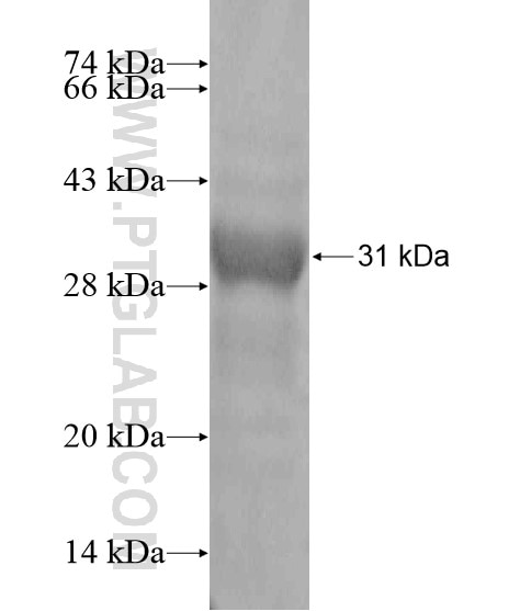 SPSB1 fusion protein Ag20167 SDS-PAGE