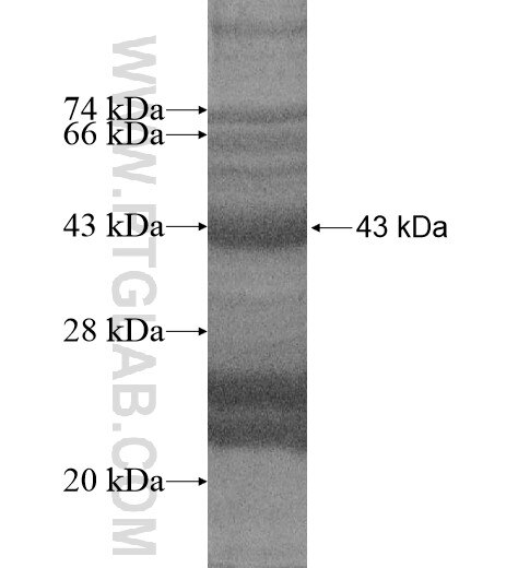 SPSB2 fusion protein Ag13991 SDS-PAGE