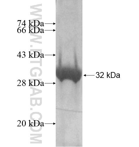 SPSB4 fusion protein Ag15063 SDS-PAGE