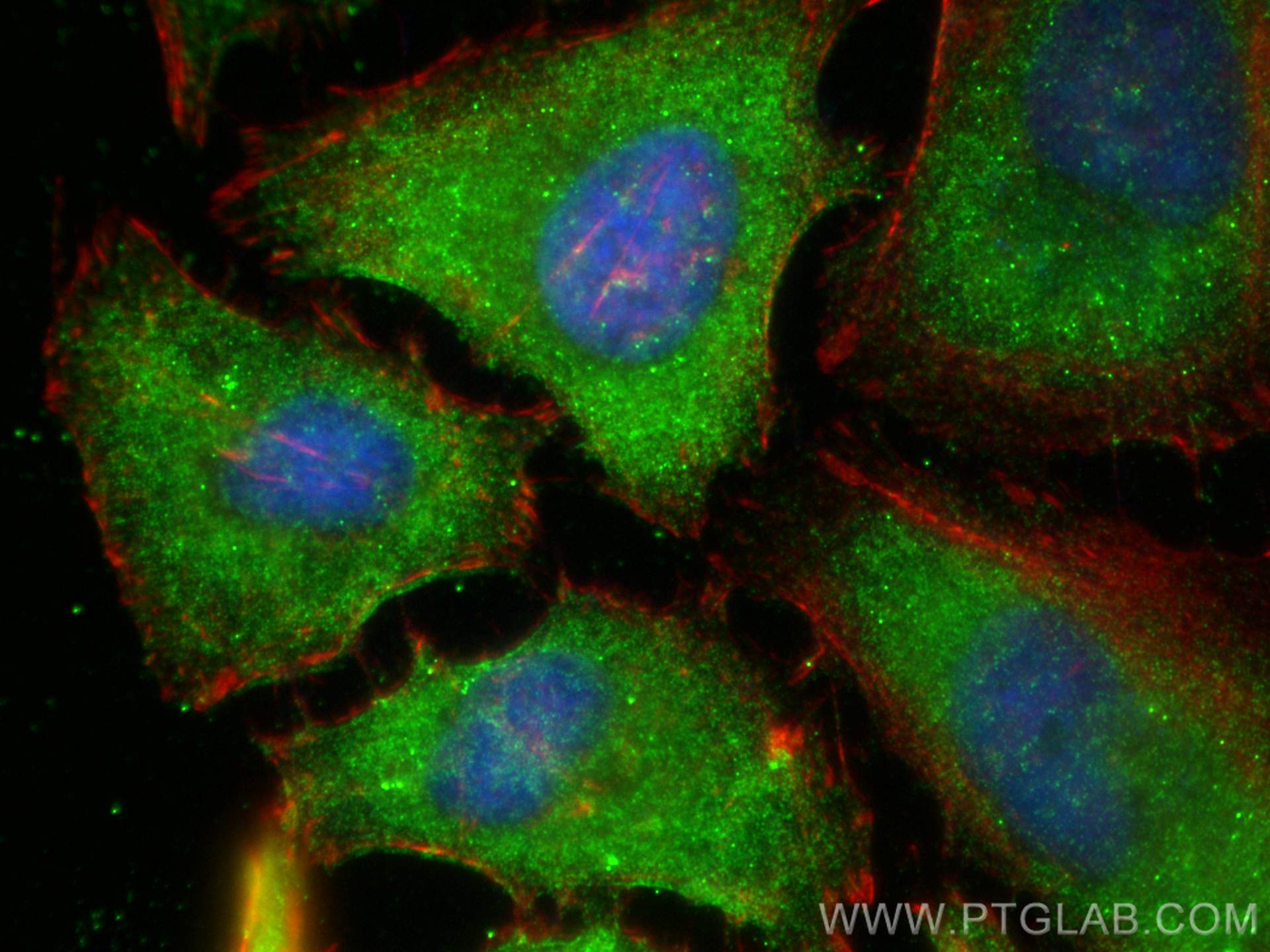 Immunofluorescence (IF) / fluorescent staining of HeLa cells using SPTAN1 Polyclonal antibody (31676-1-AP)