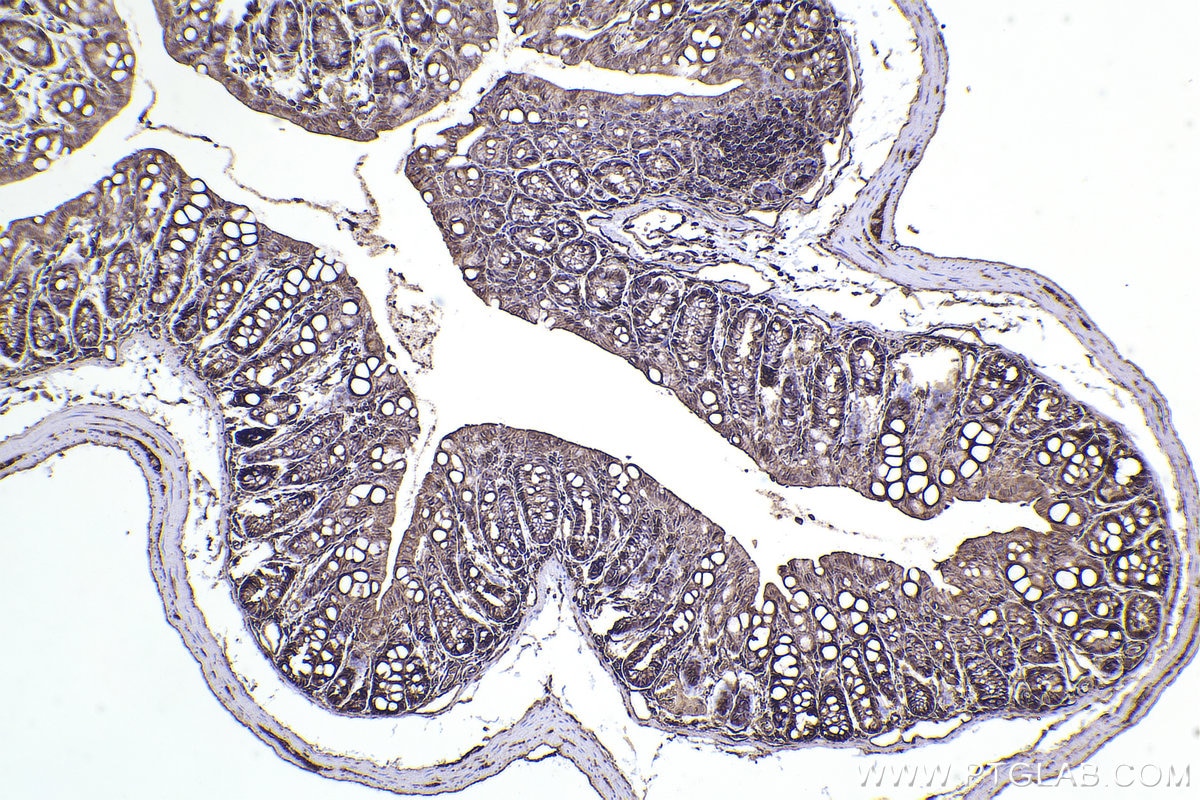 Immunohistochemistry (IHC) staining of mouse colon tissue using SPTAN1 Polyclonal antibody (31676-1-AP)