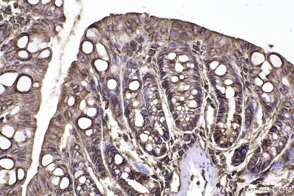 Immunohistochemistry (IHC) staining of mouse colon tissue using SPTAN1 Polyclonal antibody (31676-1-AP)