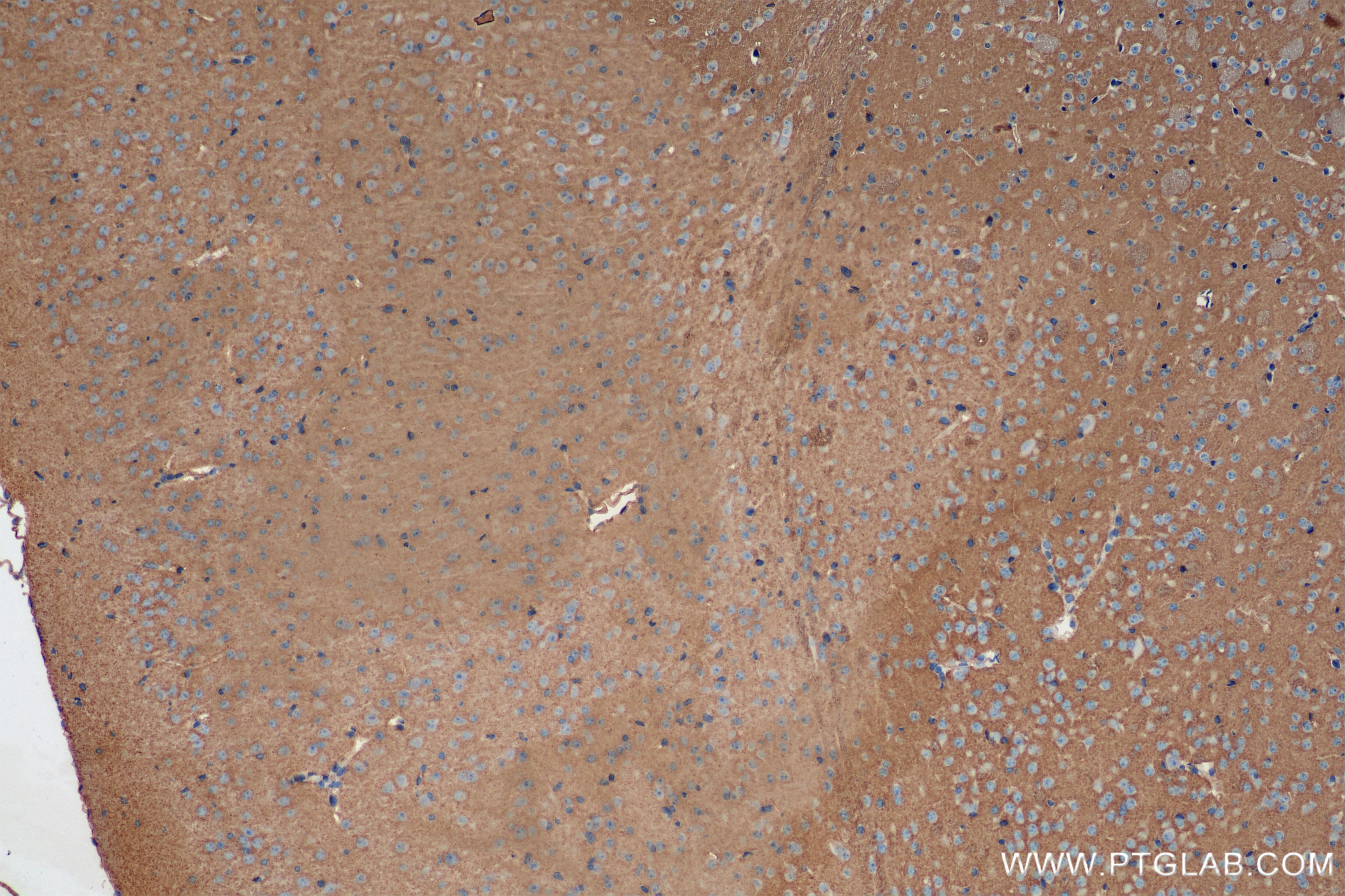 Immunohistochemistry (IHC) staining of mouse brain tissue using SPTAN1 Recombinant antibody (84761-2-RR)