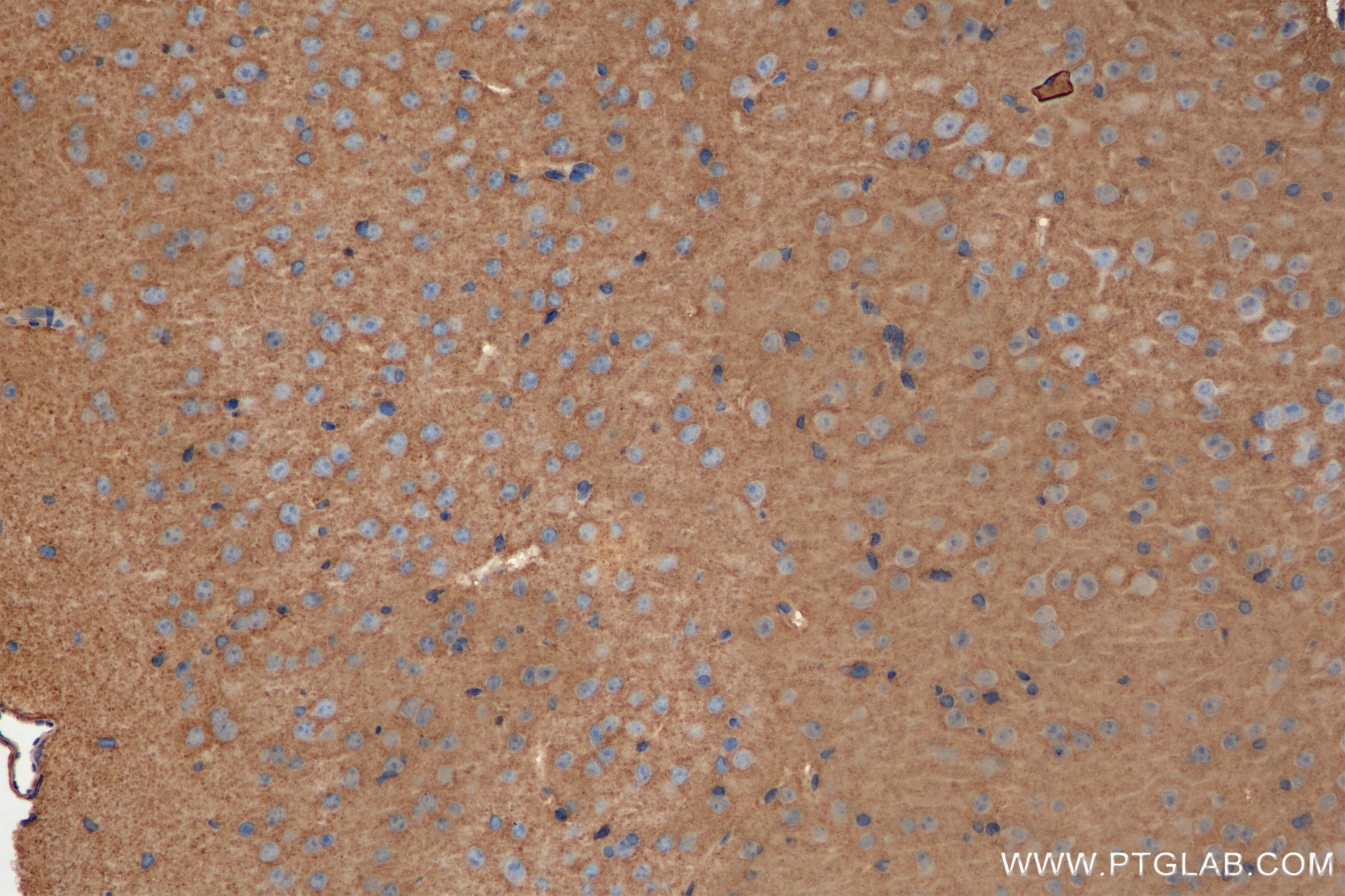 Immunohistochemistry (IHC) staining of mouse brain tissue using SPTAN1 Recombinant antibody (84761-2-RR)