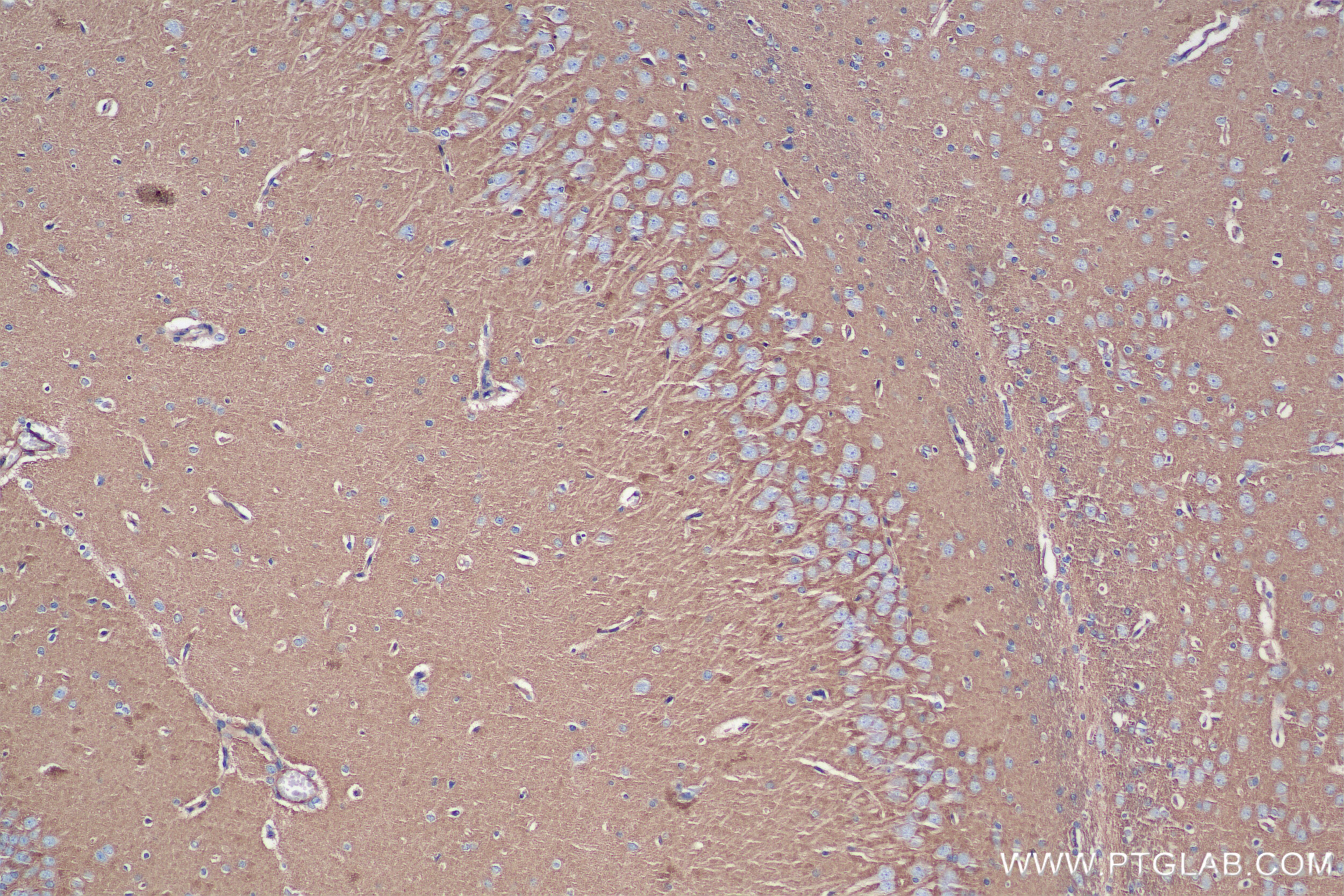 Immunohistochemistry (IHC) staining of rat brain tissue using SPTAN1 Recombinant antibody (84761-2-RR)