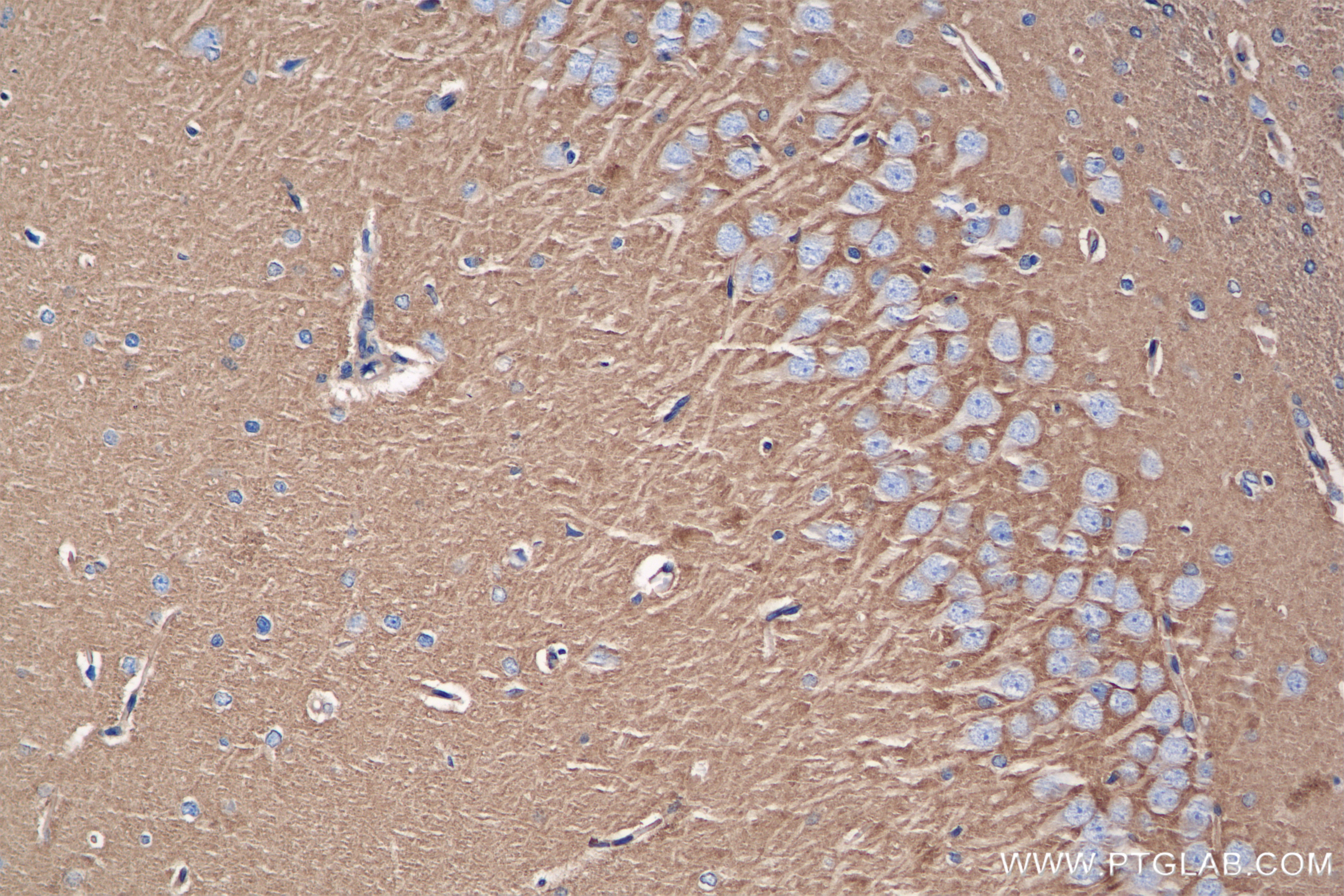 Immunohistochemistry (IHC) staining of rat brain tissue using SPTAN1 Recombinant antibody (84761-2-RR)