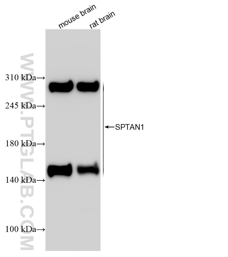 Western Blot (WB) analysis of mouse brain tissue using SPTAN1 Recombinant antibody (84761-2-RR)
