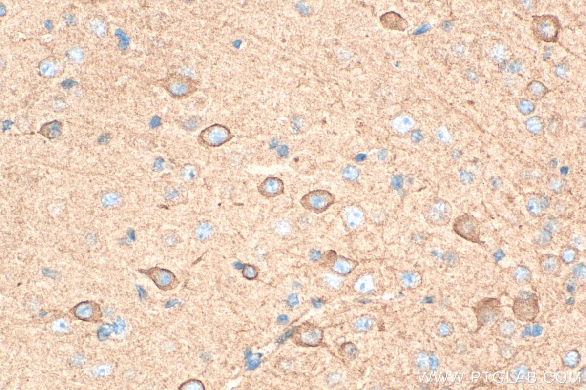 Immunohistochemistry (IHC) staining of mouse brain tissue using SPTB Polyclonal antibody (26936-1-AP)
