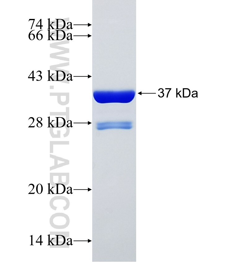 SPTB fusion protein Ag25614 SDS-PAGE