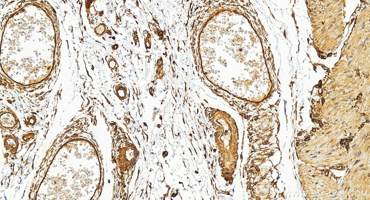 Immunohistochemical analysis of paraffin-embedded human stomach tissue slide using 25681-1-AP (SPTBN1 antibody) at dilution of 1:300 (under 20x lens). Heat mediated antigen retrieval with Tris-EDTA buffer (pH 9.0). Immunohistochemistry (IHC) staining of human stomach tissue using SPTBN1 Polyclonal antibody (25681-1-AP)