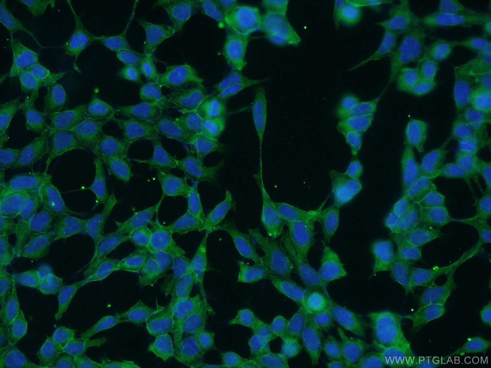 Immunofluorescence (IF) / fluorescent staining of HEK-293 cells using SPTBN1 Polyclonal antibody (25681-1-AP)