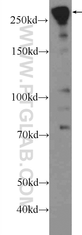 Western Blot (WB) analysis of mouse heart tissue using SPTBN1 Polyclonal antibody (25681-1-AP)