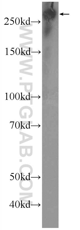 Western Blot (WB) analysis of HEK-293 cells using SPTBN1 Polyclonal antibody (25681-1-AP)