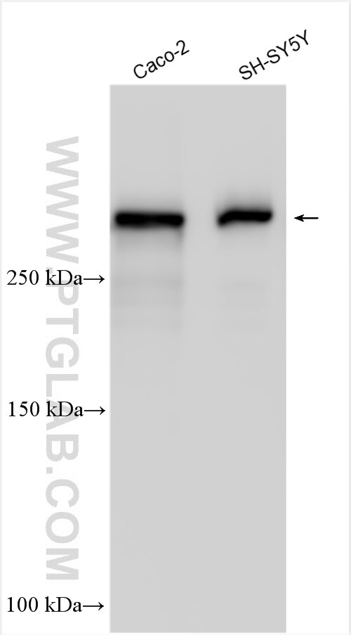 Western Blot (WB) analysis of various lysates using SPTBN1 Polyclonal antibody (25681-1-AP)