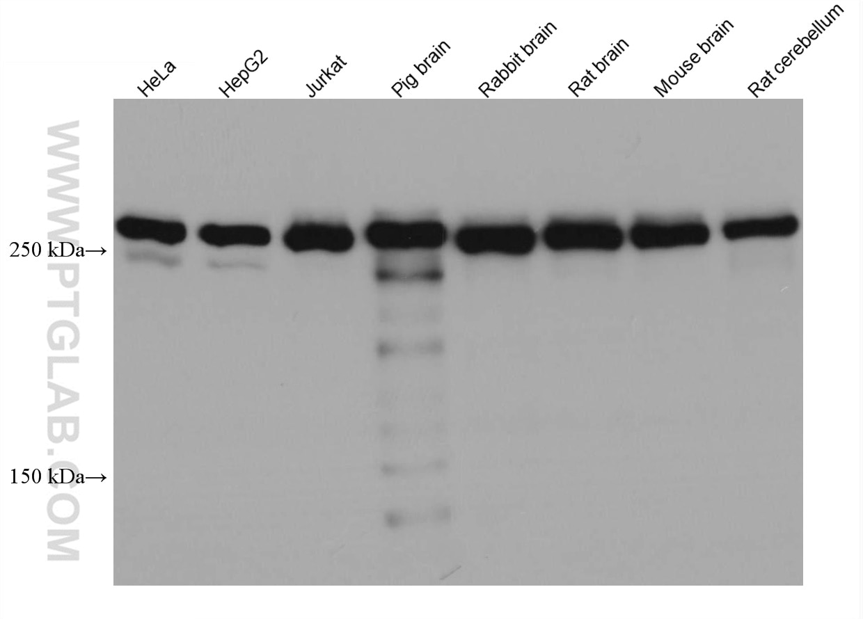 Western Blot (WB) analysis of various lysates using SPTBN1 Monoclonal antibody (67978-1-Ig)
