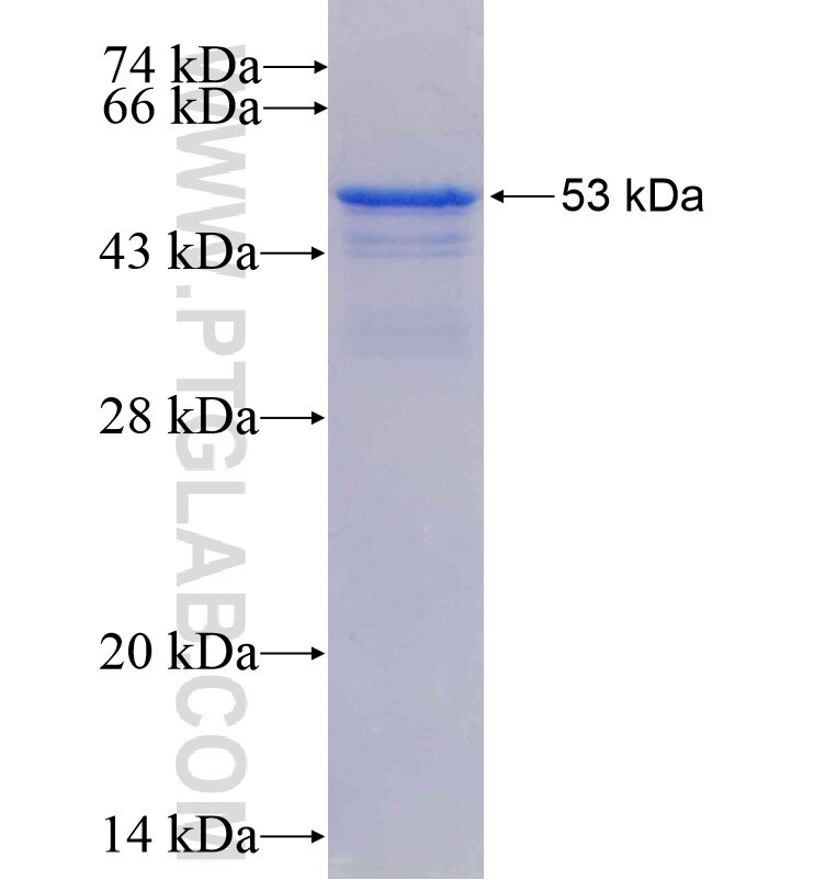 SPTBN1 fusion protein Ag22459 SDS-PAGE