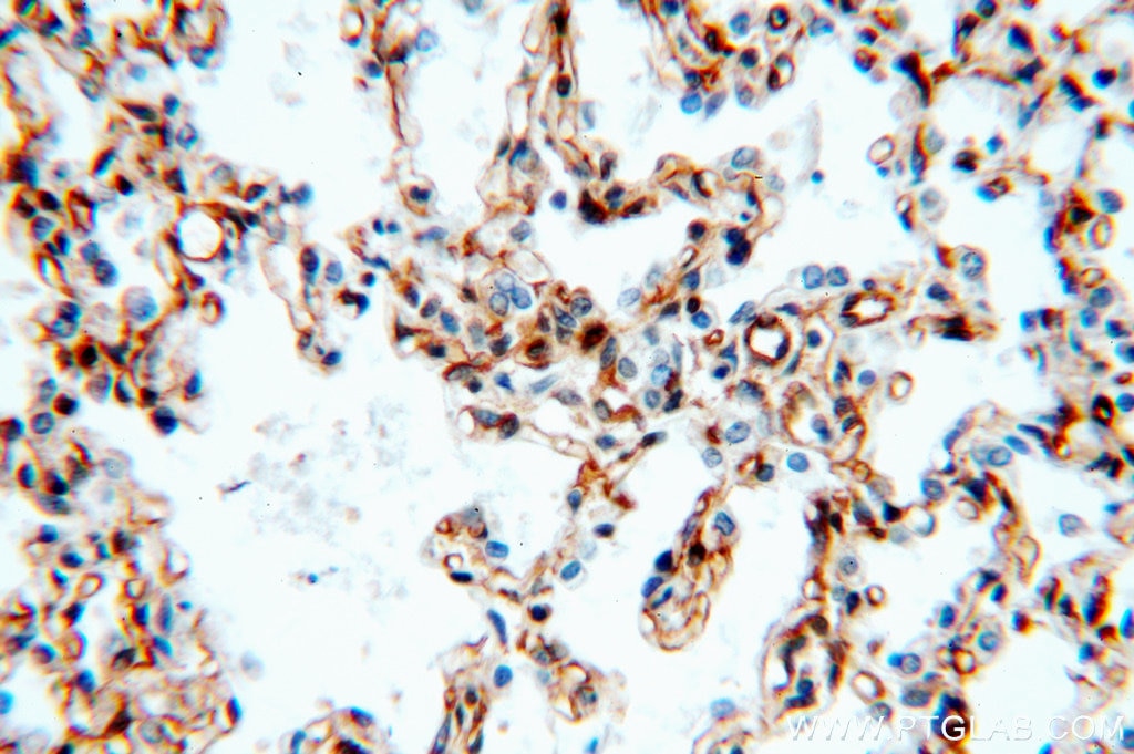 Immunohistochemistry (IHC) staining of human lung tissue using SPTBN1-Specific Polyclonal antibody (19722-1-AP)