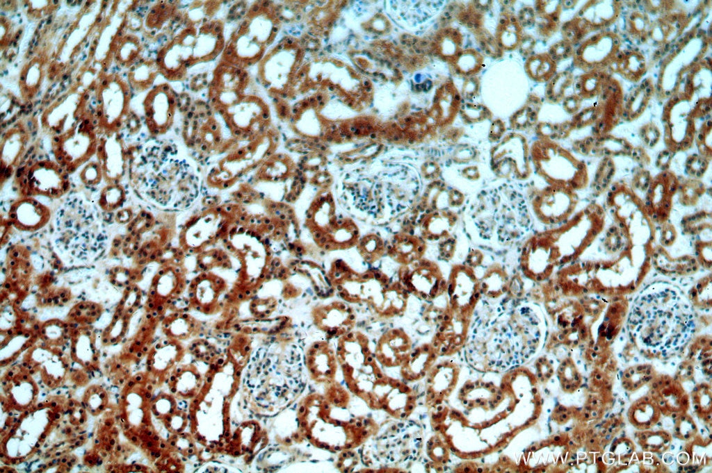 Immunohistochemistry (IHC) staining of human kidney tissue using SPTBN1-Specific Polyclonal antibody (19722-1-AP)