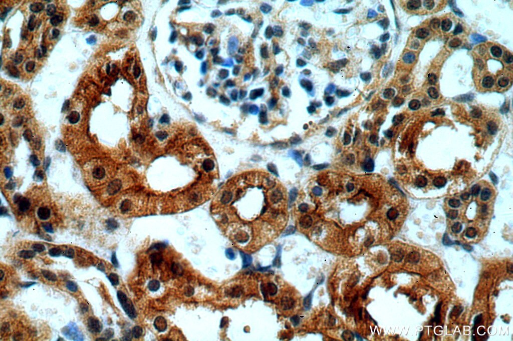 Immunohistochemistry (IHC) staining of human kidney tissue using SPTBN1-Specific Polyclonal antibody (19722-1-AP)