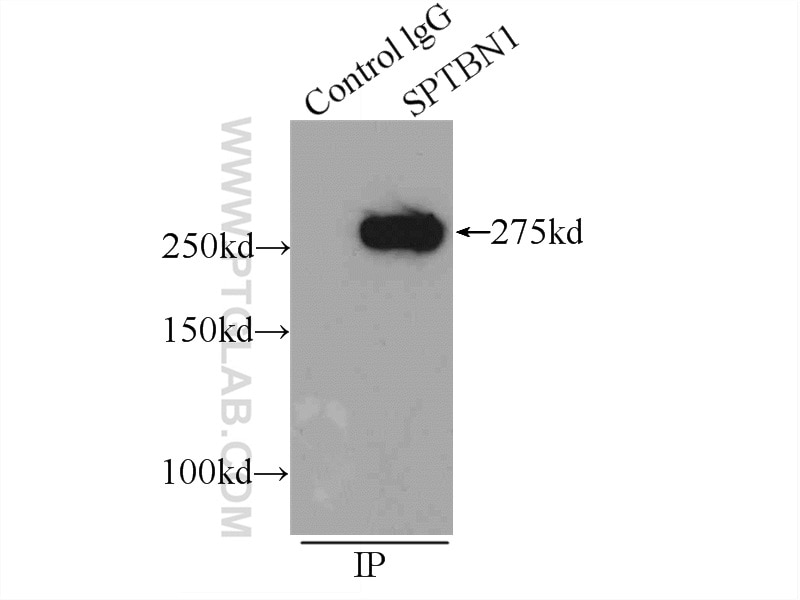 Immunoprecipitation (IP) experiment of HEK-293 cells using SPTBN1-Specific Polyclonal antibody (19722-1-AP)