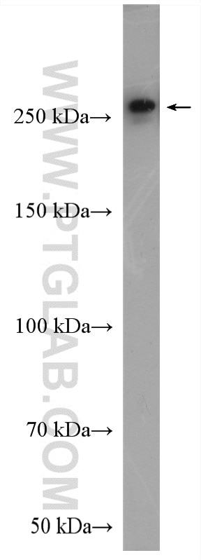 Western Blot (WB) analysis of mouse lung tissue using SPTBN1-Specific Polyclonal antibody (19722-1-AP)