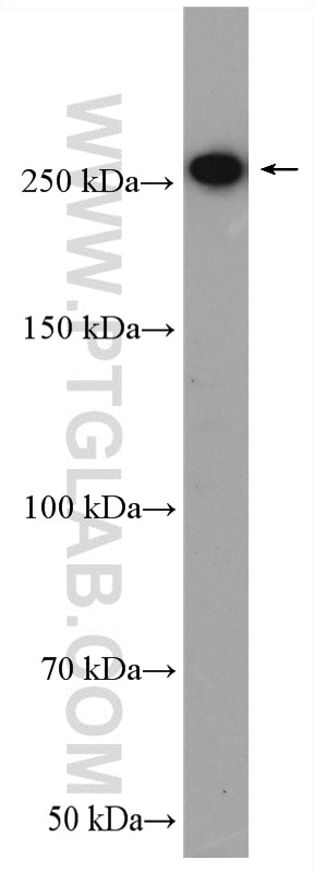 Western Blot (WB) analysis of mouse brain tissue using SPTBN1-Specific Polyclonal antibody (19722-1-AP)