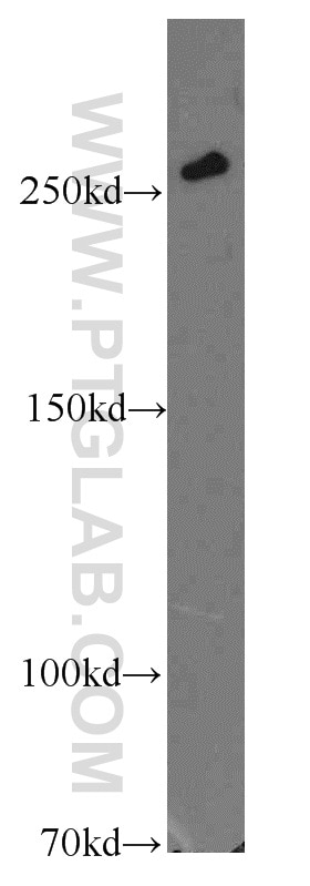 Western Blot (WB) analysis of mouse kidney tissue using SPTBN1-Specific Polyclonal antibody (19722-1-AP)