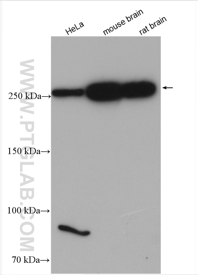 Western Blot (WB) analysis of various lysates using SPTBN2 Polyclonal antibody (55107-1-AP)