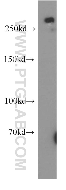 Western Blot (WB) analysis of human brain tissue using SPTBN2 Polyclonal antibody (55107-1-AP)