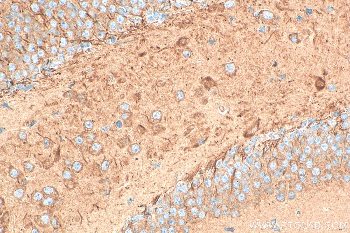 Immunohistochemistry (IHC) staining of mouse brain tissue using SPTBN4 Polyclonal antibody (31713-1-AP)