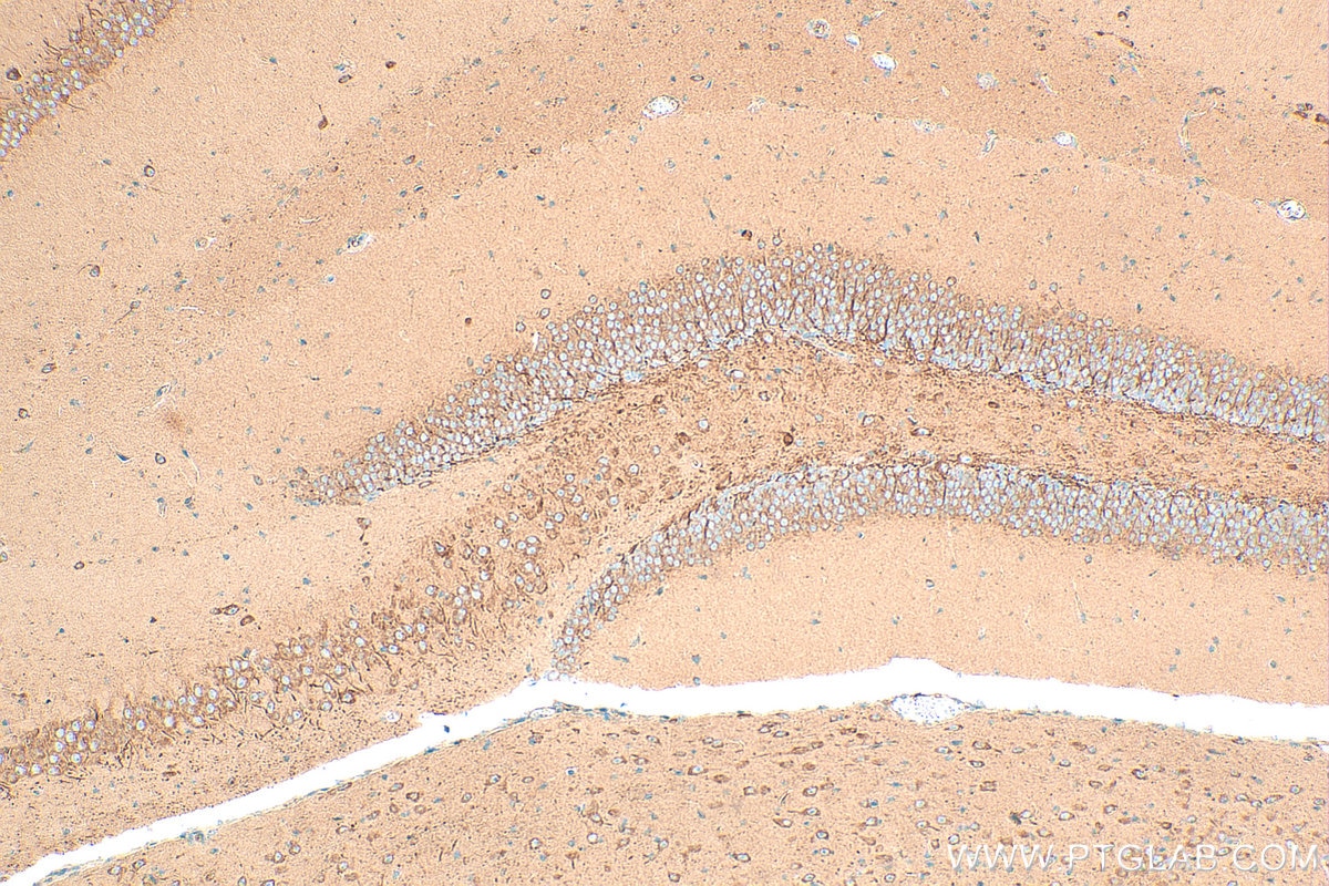 Immunohistochemistry (IHC) staining of mouse brain tissue using SPTBN4 Polyclonal antibody (31713-1-AP)
