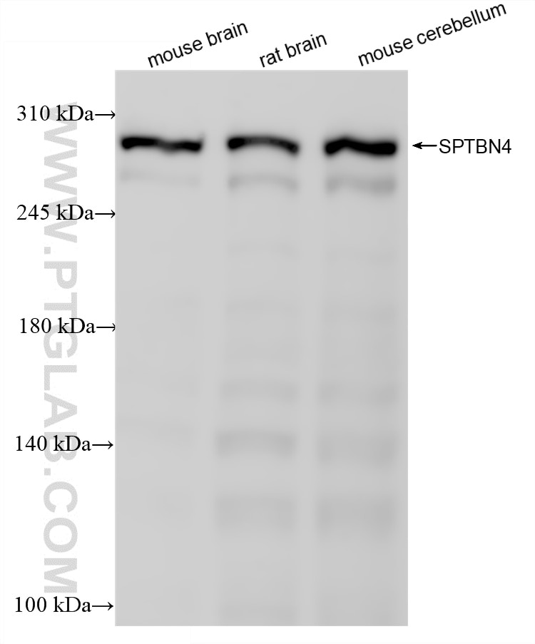 WB analysis using 87776-1-RR (same clone as 87776-1-PBS) Western Blot (WB) analysis of various lysates using SPTBN4 Recombinant monoclonal antibody (87776-1-RR)