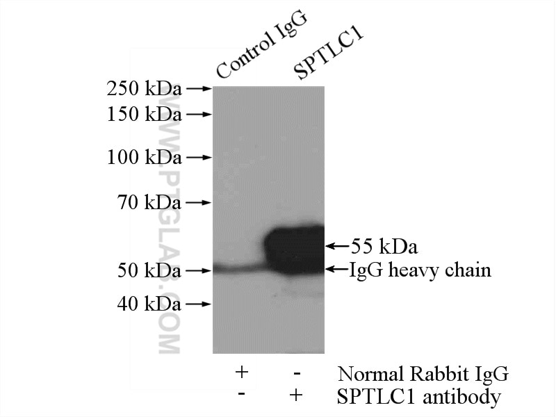Immunoprecipitation (IP) experiment of HEK-293 cells using SPTLC1 Polyclonal antibody (15376-1-AP)