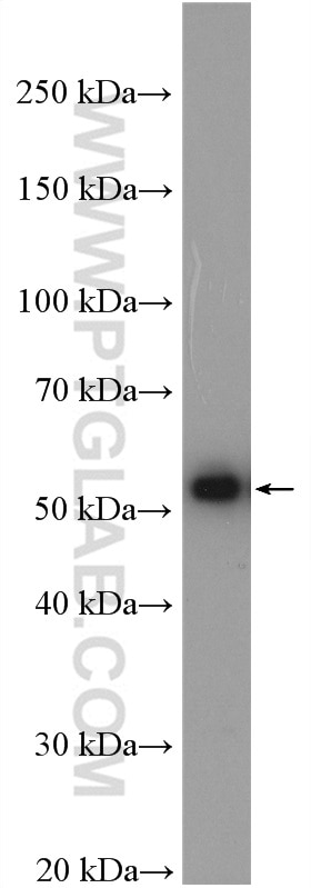 Western Blot (WB) analysis of Jurkat cells using SPTLC1 Polyclonal antibody (15376-1-AP)