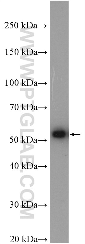 WB analysis of Jurkat using 15376-1-AP