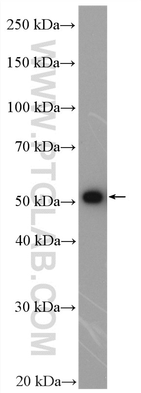 Western Blot (WB) analysis of HepG2 cells using SPTLC1 Polyclonal antibody (15376-1-AP)