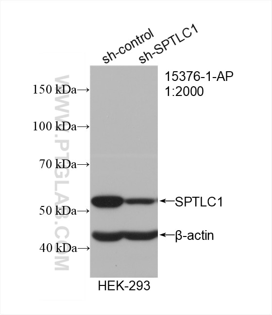 Western Blot (WB) analysis of HEK-293 cells using SPTLC1 Polyclonal antibody (15376-1-AP)