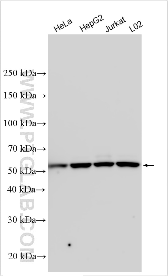 Western Blot (WB) analysis of various lysates using SPTLC1 Polyclonal antibody (15376-1-AP)