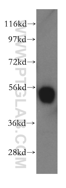 SPTLC1