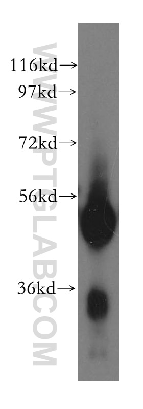 Western Blot (WB) analysis of human liver tissue using SPTLC1 Polyclonal antibody (15376-1-AP)