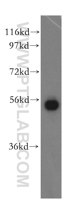 Western Blot (WB) analysis of HEK-293 cells using SPTLC1 Polyclonal antibody (15376-1-AP)