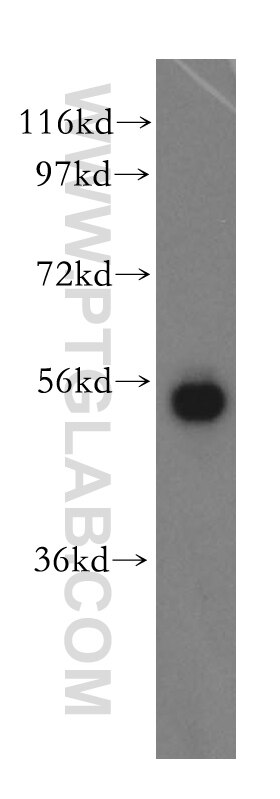 Western Blot (WB) analysis of HEK-293 cells using SPTLC1 Polyclonal antibody (15376-1-AP)